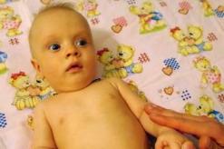 Что такое перинатальная энцефалопатия новорожденных